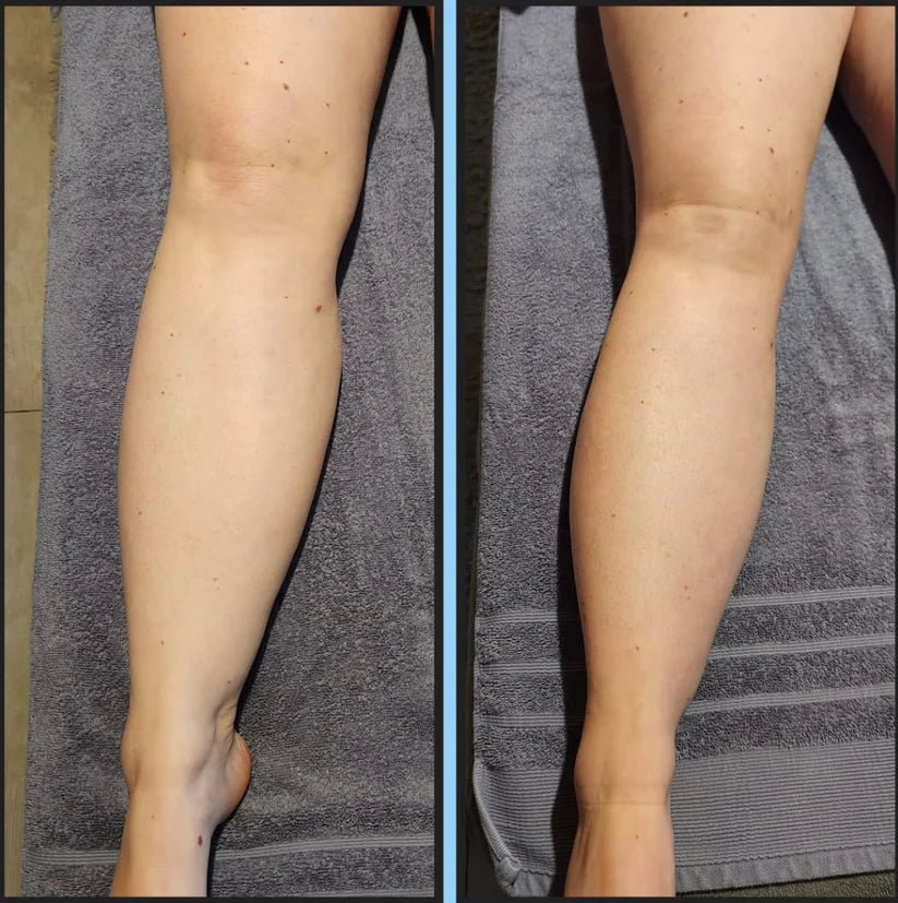 Lymphatic Drainage - Reveless