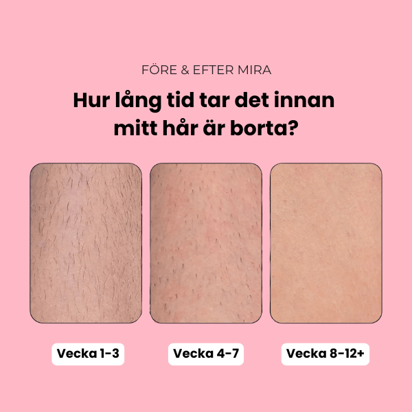Mira - IPL Hårborttagning - Reveless