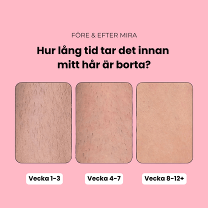 Mira - IPL Hårborttagning - Reveless