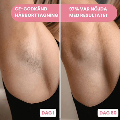 Mira - IPL Hårborttagning - Reveless